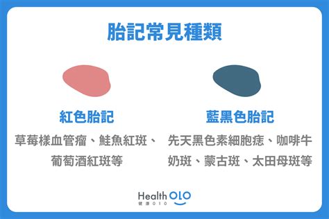 咖啡牛奶斑胎記|胎記怎麼產生、何時消除？醫師剖析胎記種類、胎記寓。